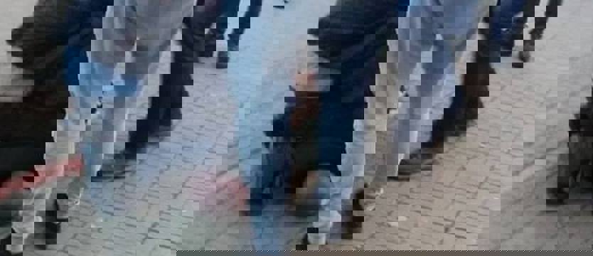 Atak na czarnoskórego obcokrajowca