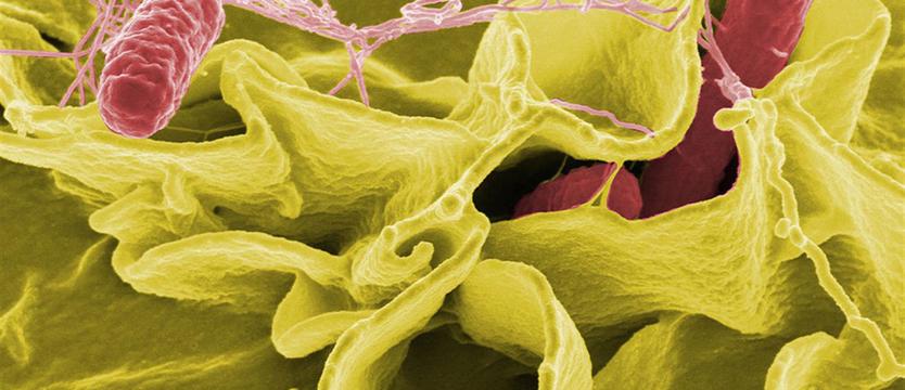 Salmonella zamknęła przedszkole