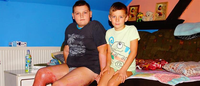 Pomóżmy Maćkowi. Omal nie zginął w płomieniach