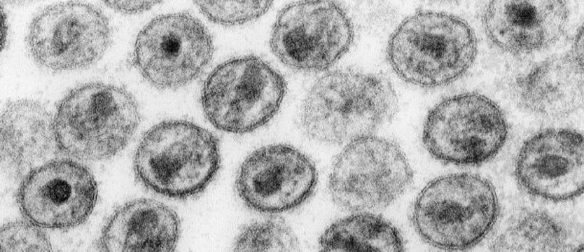Drugi przypadek wyleczenia zakażenia wirusem HIV