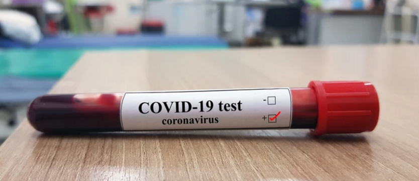 Testy na koronawirusa w Wojewódzkiej Stacji Sanitarno-Epidemiologicznej w Szczecinie