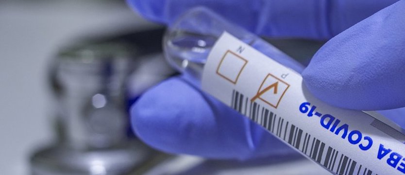 W kraju w niedzielę prawie 7700 zakażeń SARS-CoV-2. Tydzień temu było więcej