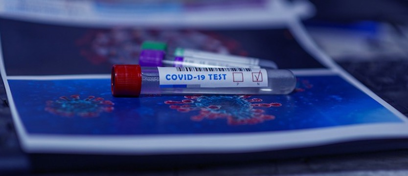 W czwartek 251 zakażeń COVID-19 w całym kraju. W naszym regionie 11