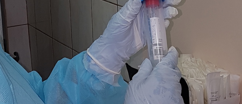 Przeszło 1400 przypadków SARS-CoV-2 w środę w regionie. Zmarło 25 osób