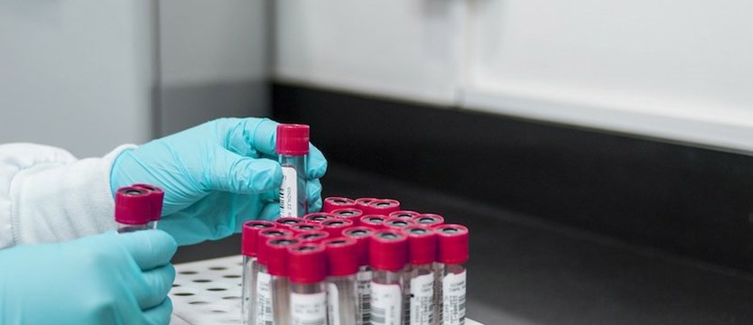 W kraju 4 255 nowych zakażeń koronawirusem. Zmarły 343 osoby