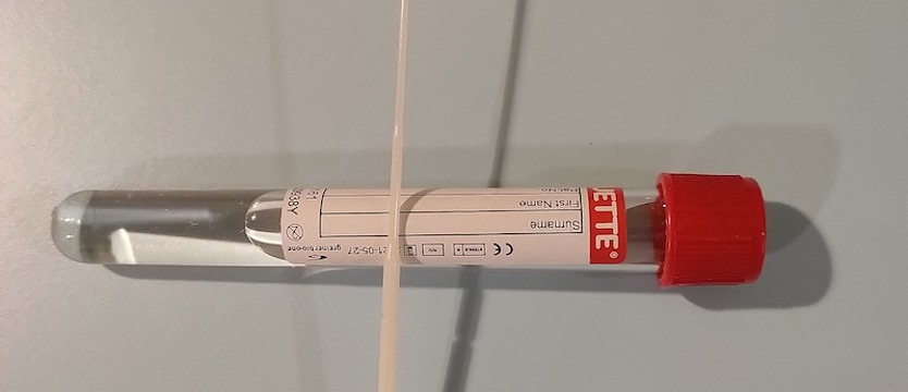 W poniedziałek ponad 13 tys. przypadków SARS-CoV-2.  Znowu tygodniowy wzrost zakażeń
