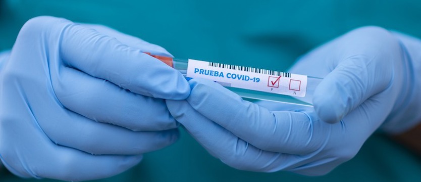 Ministerstwo Zdrowia: mamy tylko 17 w regionie i 381 w kraju przypadków koronawirusa