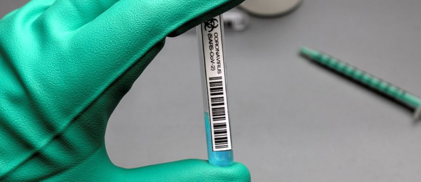 Brytyjska odmiana koronawirusa wykryta w Polsce