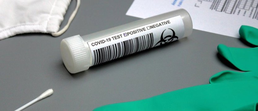 Rozpoczynają się testy nauczycieli na obecność SARS-CoV-2