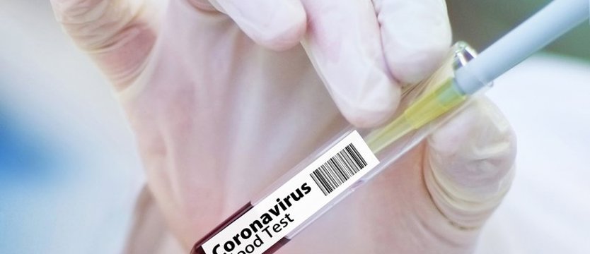 W poniedziałek w kraju prawie 17 tys. przypadków koronawirusa