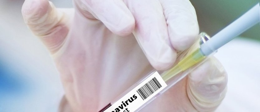W kraju w sobotę ponad 6 tys. zakażeń wirusem SARS-CoV-2. Zmarło 75 osób